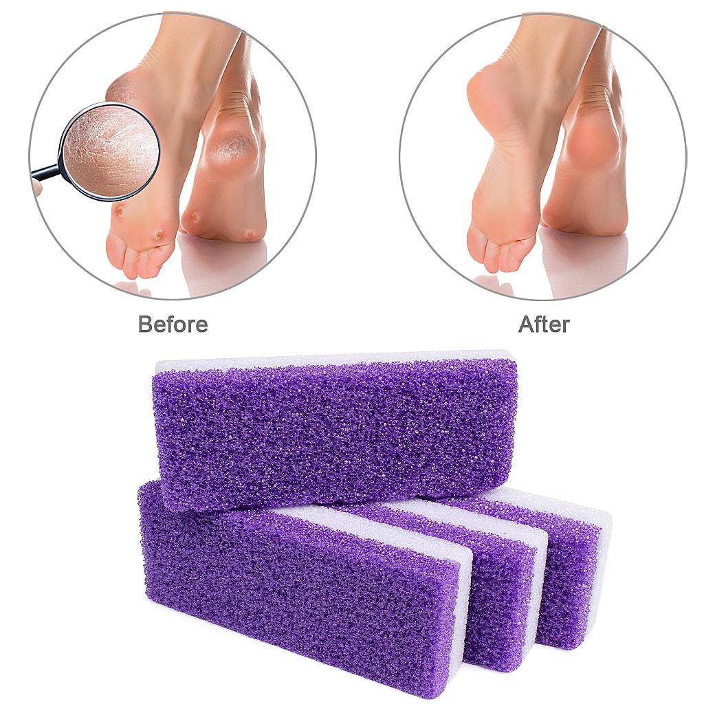 Double Sided Pumice Stone Callus, Hard Skin Callus Remover and Scrubber Pedicure Tools Foot File for Feet Hands Exfoliator Pedicure Feet File - 副本
